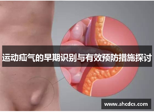 运动疝气的早期识别与有效预防措施探讨